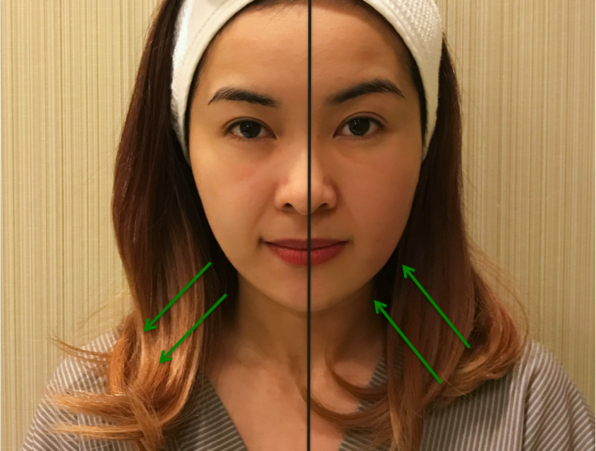 Say Goodbye to Chubby Cheeks (without Surgery or Makeup)