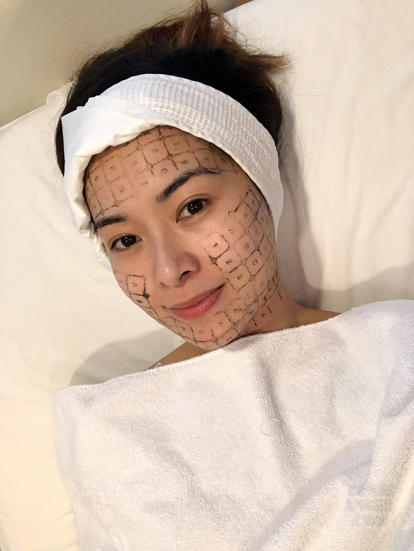 Facial Care Centre Thermage Review + Before and After Photos Lush Angel